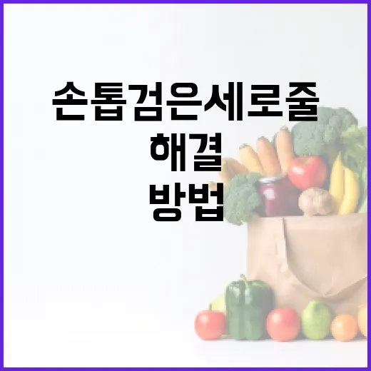 손톱 검은세로줄을 이해하고 해결하는 방법 - 요약