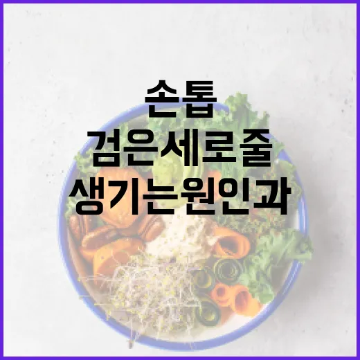 손톱에 검은 세로줄이 생기는 원인과 해결 방법 - 요약