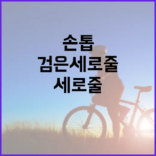 손톱에 검은 세로줄이 생기는 이유와 해결 방법 - 요약