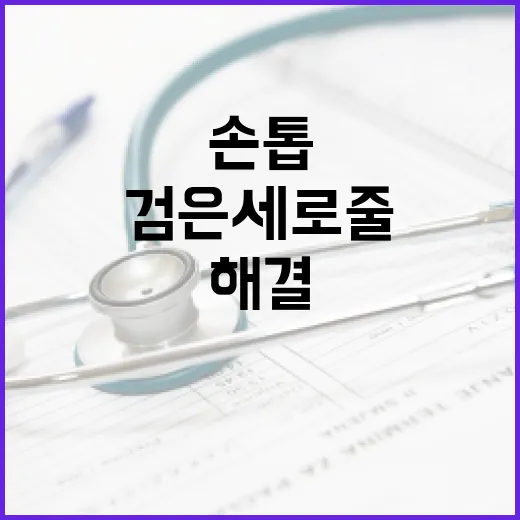 손톱에 나타나는 검은 세로줄 해결 방법 - 요약