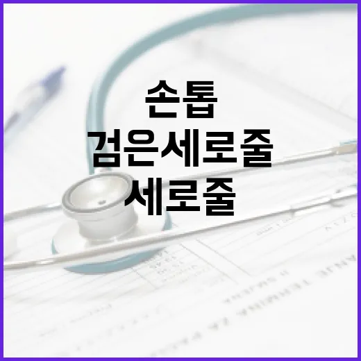 손톱에 검은 세로줄이 생기는 이유와 해결 방법 - 요약