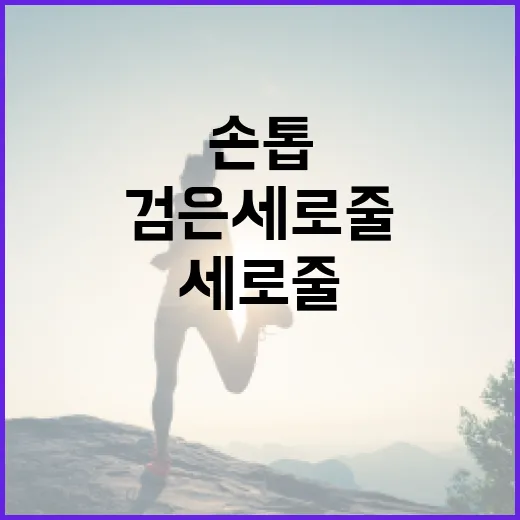 손톱에 검은 세로줄이 생기는 이유와 해결 방법 - 요약