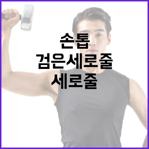 손톱에 검은 세로줄이 생기는 이유와 해결 방법 - 요약