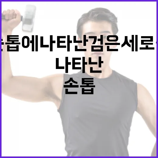 손톱에 나타난 검은 세로줄 이해하고 관리하는 방법 - 요약