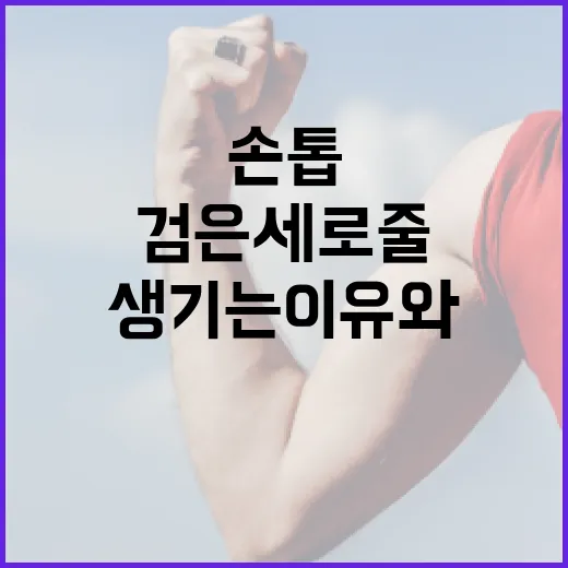 손톱에 검은세로줄이 생기는 이유와 관리 방법 - 요약