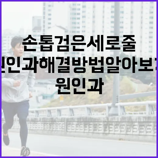 손톱 검은세로줄의 원인과 해결 방법 알아보기 - 요약