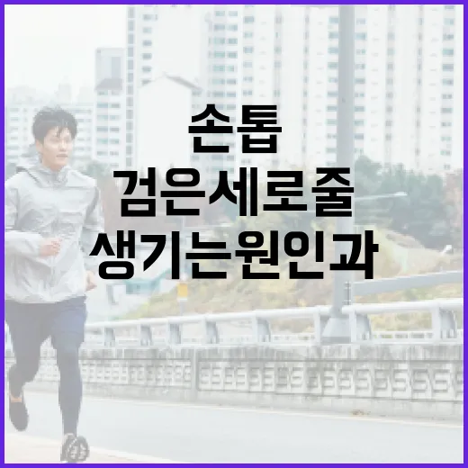 손톱에 검은 세로줄이 생기는 원인과 해결 방법 - 요약