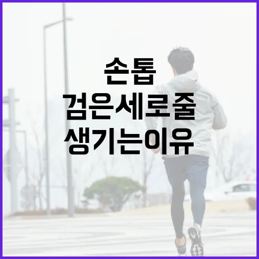 손톱에 검은 세로줄이 생기는 이유와 관리 방법 - 요약