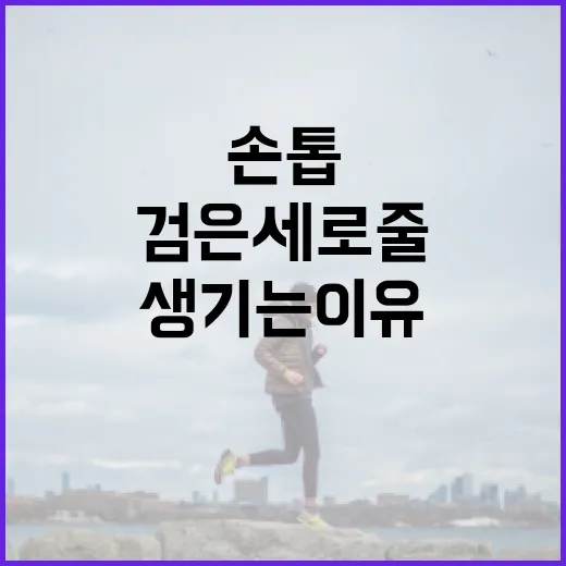 손톱에 검은 세로줄이 생기는 이유와 해결 방법 - 요약
