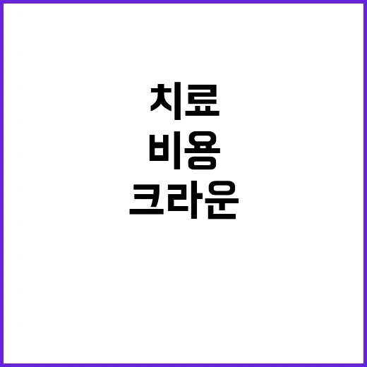 크라운치료 처음 받는 분이 순서와 비용을 확인하는 방법 - 요약