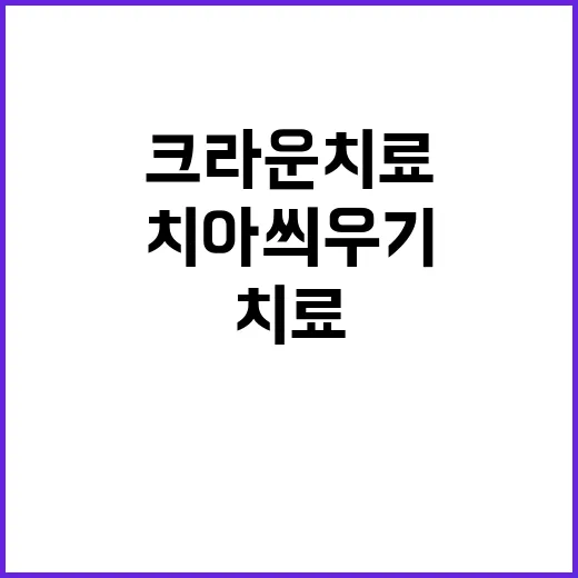 초보자를 위한 크라운치료 받는 방법, 치아 씌우기 전 알아둘 것 - 요약