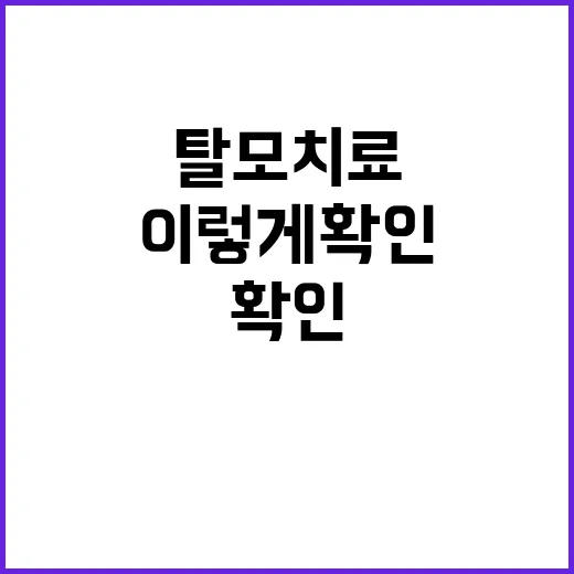 탈모치료 시작하려면 이렇게 확인하세요 - 요약