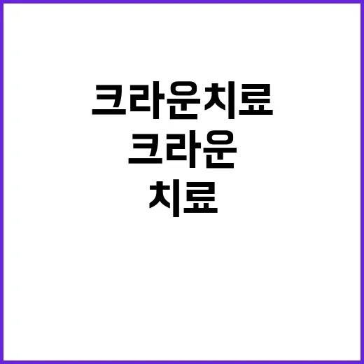크라운치료 처음 받으려면 이렇게 준비하면 됩니다 - 요약