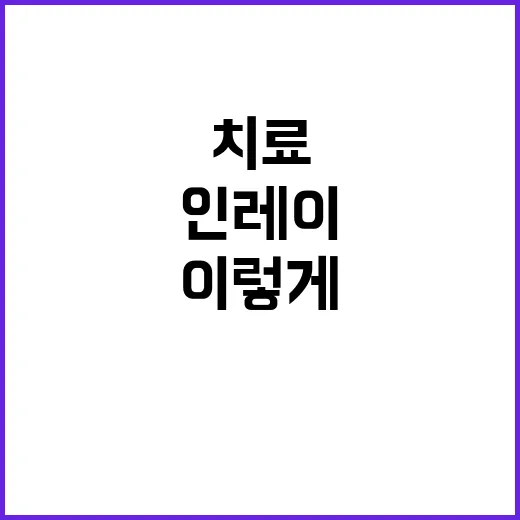 인레이치료 결정하려면 이렇게 비교하세요 - 요약