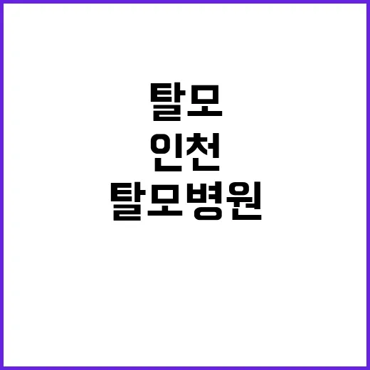 인천탈모병원 고르려면 이렇게 확인하세요 - 요약
