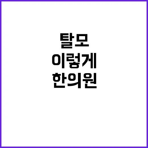 탈모한의원 처음 가려면 이렇게 준비하는 방법 - 요약