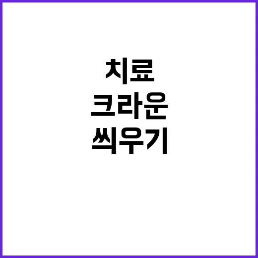 크라운치료 하려면 이렇게 확인하세요: 씌우기 전후로 꼭 물어볼 것들 - 요약