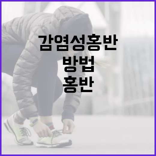 감염성 홍반, 알아두면 좋은 관리 방법 - 요약