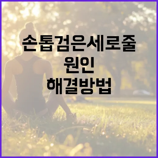 손톱 검은세로줄의 원인과 해결 방법 - 요약