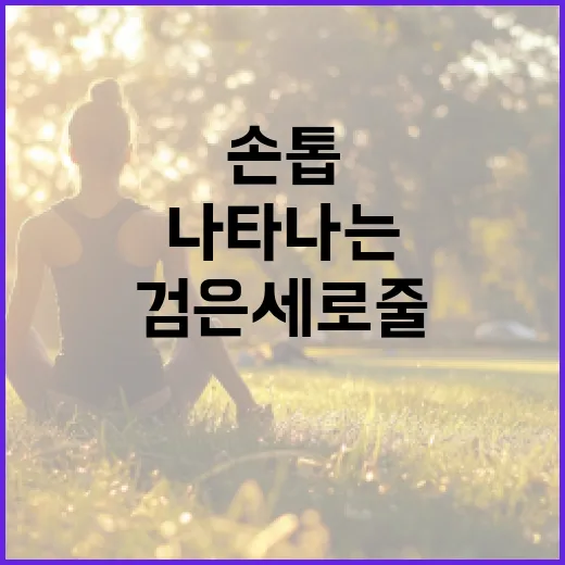 손톱에 검은 세로줄이 나타나는 이유와 해결 방법 - 요약