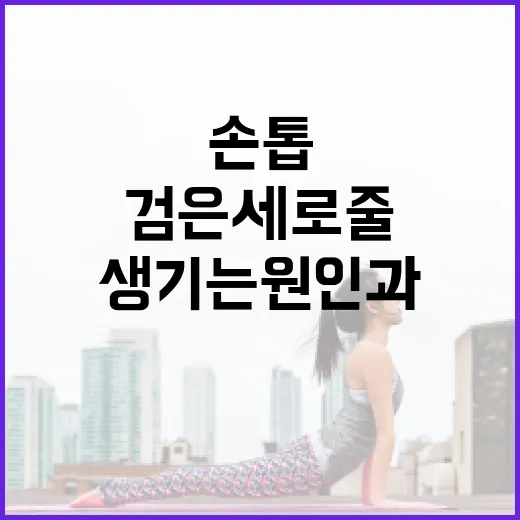 손톱에 검은 세로줄이 생기는 원인과 해결 방법 - 요약