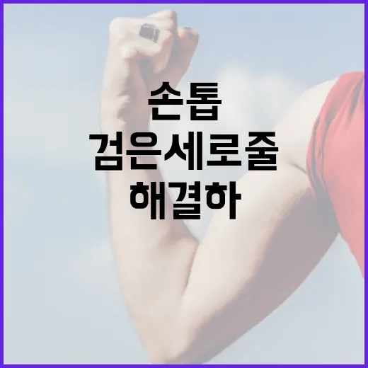 손톱의 검은 세로줄을 이해하고 해결하는 방법 - 요약