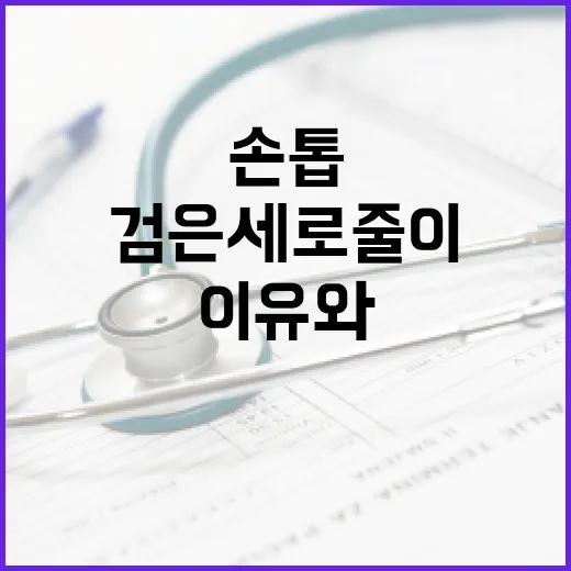 손톱 검은 세로줄이 나타나는 이유와 해결 방법 - 요약