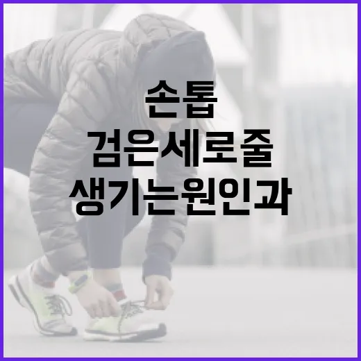 손톱에 검은 세로줄이 생기는 원인과 해결 방법 - 요약