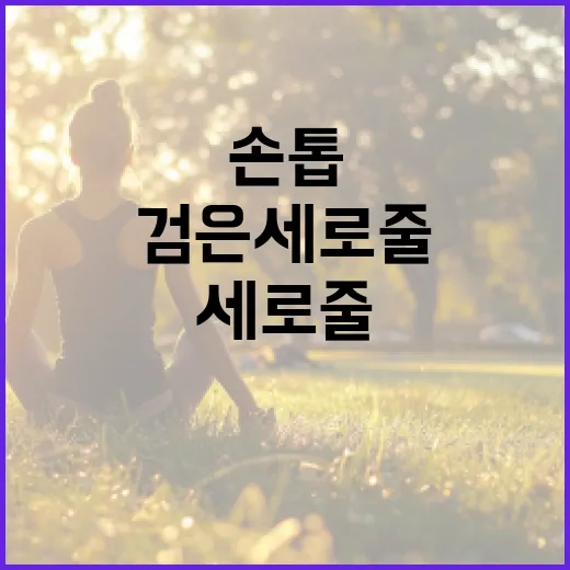 손톱에 검은 세로줄이 생기는 이유와 해결 방법 - 요약