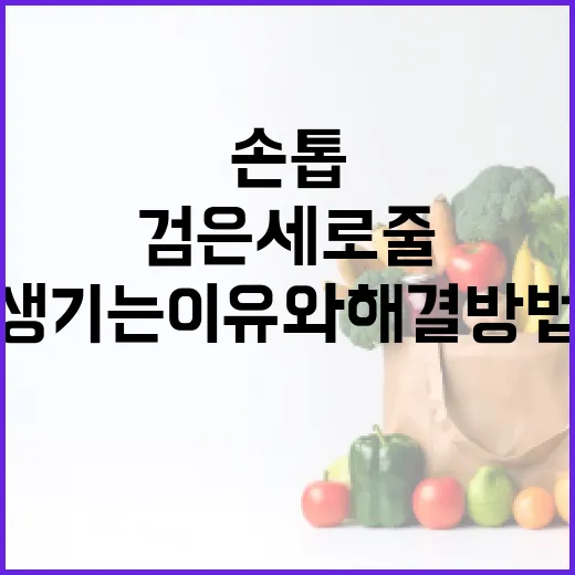 손톱에 검은세로줄이 생기는 이유와 해결 방법 - 요약