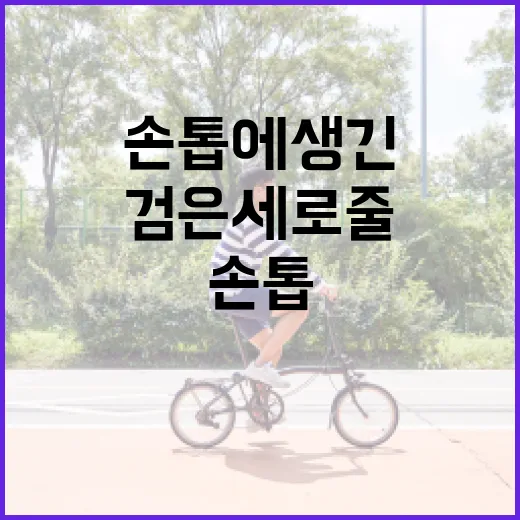 손톱에 생긴 검은 세로줄을 해결하려면 이렇게 - 요약