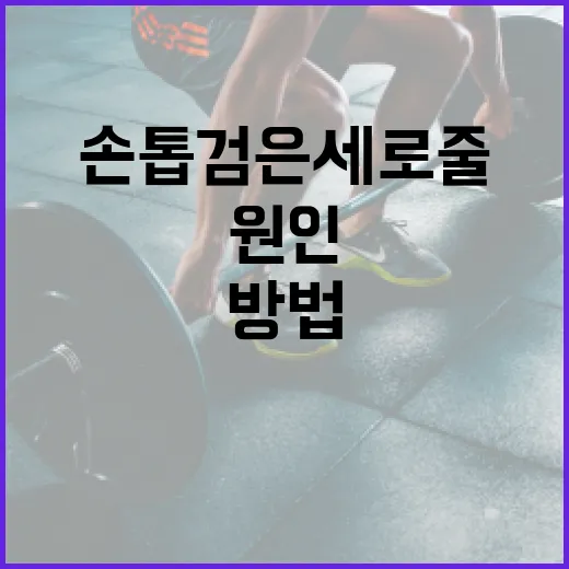 손톱 검은세로줄의 원인과 해결 방법 - 요약