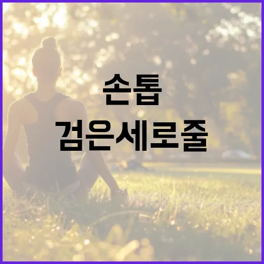 손톱의 검은 세로줄을 확인하는 방법과 건강 관리 팁 - 요약