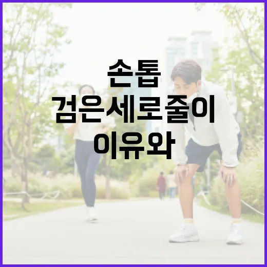 손톱 검은 세로줄이 나타나는 이유와 해결 방법 - 요약
