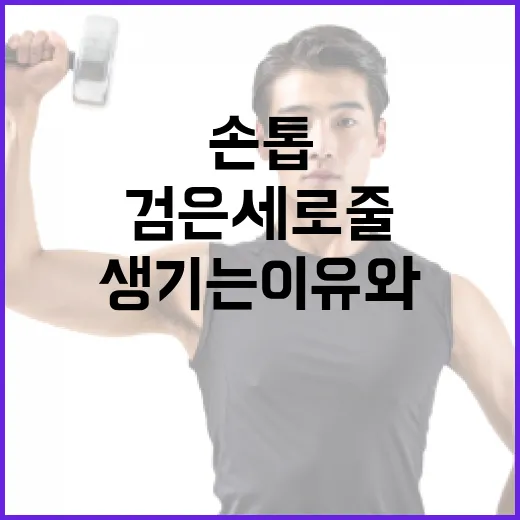 손톱에 검은 세로줄이 생기는 이유와 대처 방법 - 요약