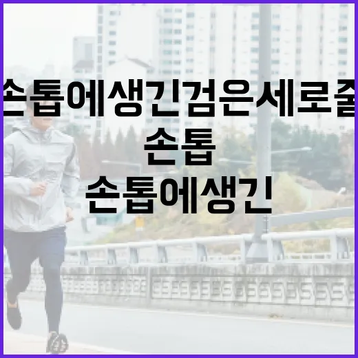 손톱에 생긴 검은 세로줄 이해하고 관리하는 방법 - 요약