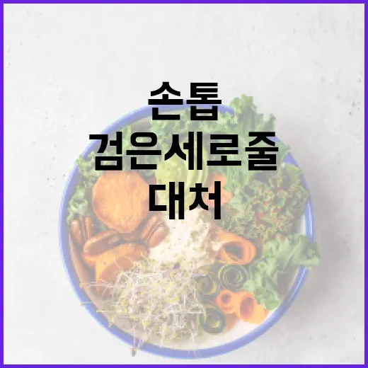 손톱에 나타나는 검은 세로줄을 이해하고 대처하는 방법 - 요약