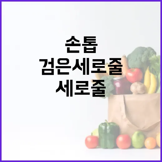 손톱에 검은 세로줄이 생기는 이유와 해결 방법 - 요약