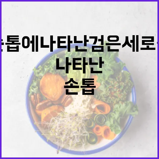 손톱에 나타난 검은 세로줄을 관리하는 방법 - 요약