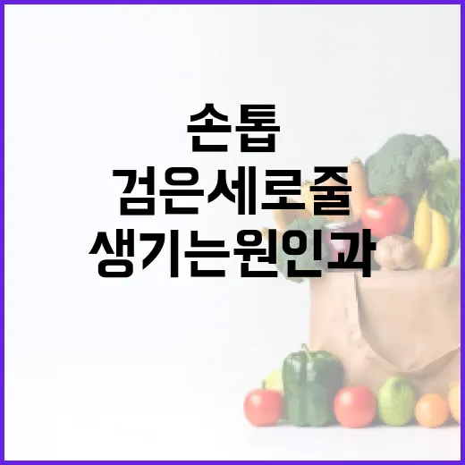 손톱에 검은 세로줄이 생기는 원인과 해결 방법 - 요약