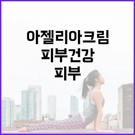 아젤리아크림을 활용하여 피부 건강을 개선하는 방법 - 요약