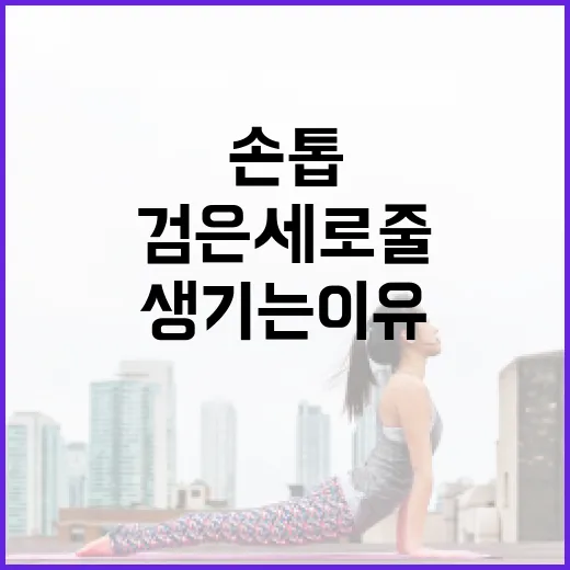 손톱에 검은 세로줄이 생기는 이유와 해결 방법 - 요약