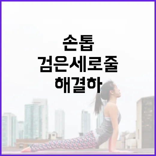 손톱의 검은 세로줄을 이해하고 해결하는 방법 - 요약