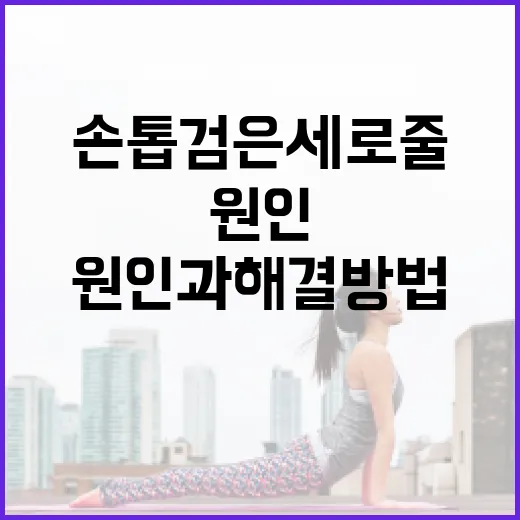 손톱 검은 세로줄의 원인과 해결 방법 - 요약