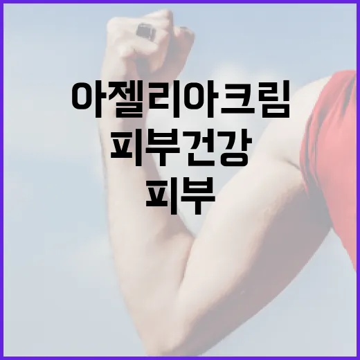 아젤리아크림을 활용하여 피부 건강을 개선하는 방법 - 요약