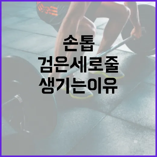 손톱에 검은 세로줄이 생기는 이유와 해결 방법 - 요약