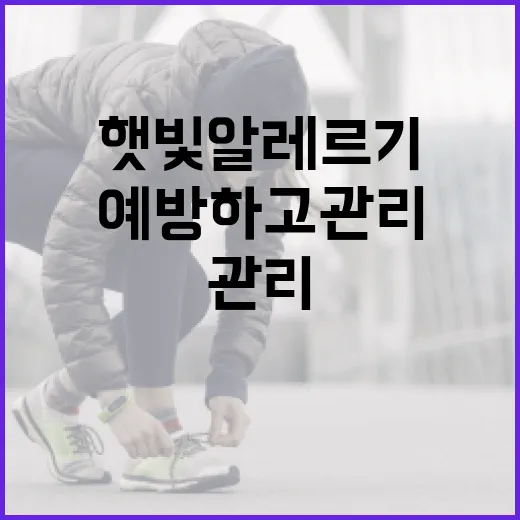 햇빛 알레르기를 예방하고 관리하는 방법 - 요약