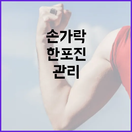 손가락 한포진 관리하는 방법: 초보자도 쉽게 이해할 수 있어요! - 요약