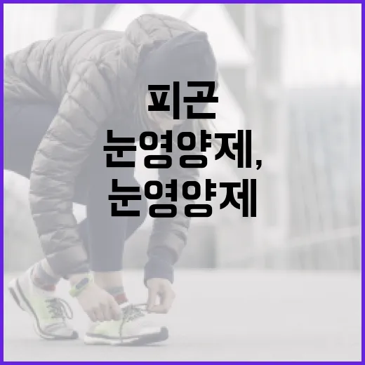 눈영양제, 피곤한 눈에도 정말 필요할까요? - 요약