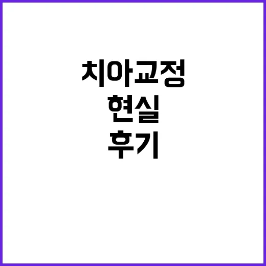 치아교정 상담만 받아보려다 현실 계산까지 해본 후기 - 요약